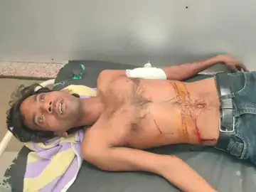 दमोह में युवक पर धारदार हथियार से हमला